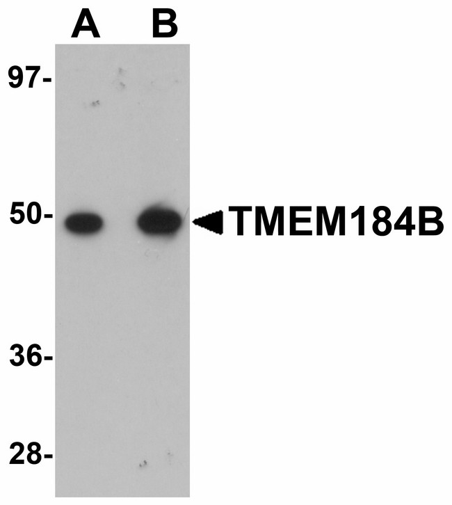 TMEM184B Antibody - Western blot of TMEM184B in rat lung tissue lysate with TMEM184B antibody at (A) 1 and (B) 2 ug/ml.