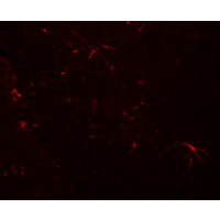 TMEM204 Antibody - Immunofluorescence of TMEM204 in mouse brain tissue with TMEM204 antibody at 20 µg/mL.