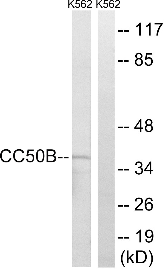 TMEM30B Antibody - Western blot analysis of lysates from K562 cells, using TMEM30B Antibody. The lane on the right is blocked with the synthesized peptide.