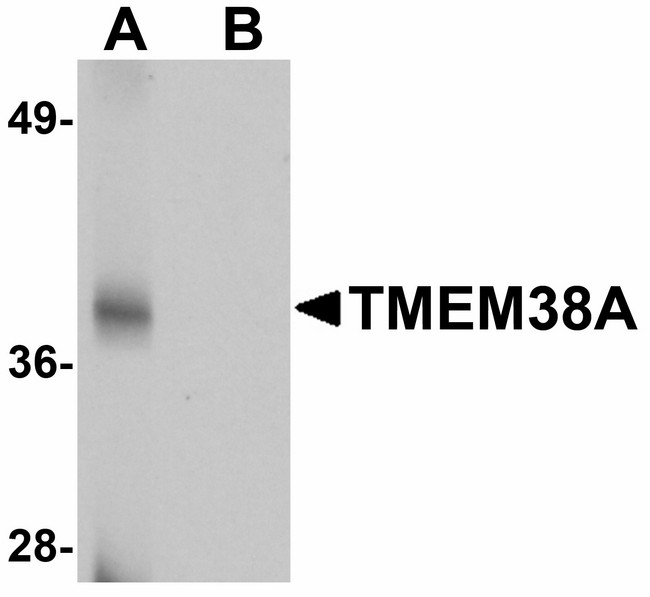 TMEM38A Antibody - Western blot of TMEM38A in rat skeletal muscle tissue lysate with TMEM38A antibody at 1 ug/ml in (A) the absence and (B) the presence of blocking peptide.