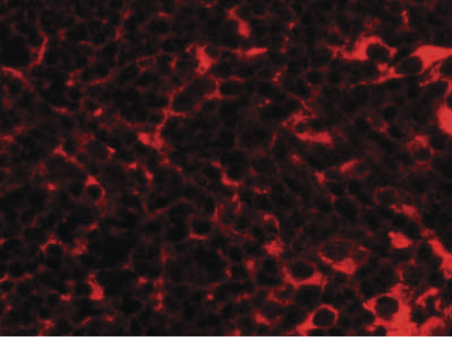 TMEM38B Antibody - Immunofluorescence of TMEM38B in mouse thymus tissue with TMEM38B antibody at 20 ug/ml.