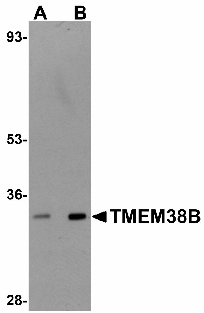 TMEM38B Antibody - Western blot of TMEM38B in rat thymus tissue lysate with TMEM38B antibody at (A) 1 and (B) 2 ug/ml.