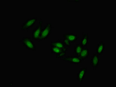 TMEM47 Antibody - Immunofluorescent analysis of Hela cells using TMEM47 Antibody at dilution of 1:100 and Alexa Fluor 488-congugated AffiniPure Goat Anti-Rabbit IgG(H+L)