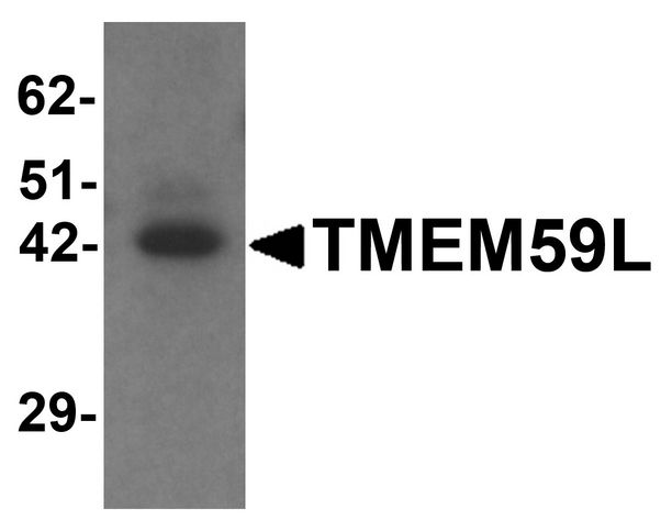 TMEM59L Antibody - Western blot analysis of TMEM59L in rat heart tissue lysate with TMEM59L antibody at 1 ug/ml.