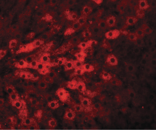 TMEM70 Antibody - Immunofluorescence of TMEM70 in rat liver tissue with TMEM70 antibody at 20 ug/ml.