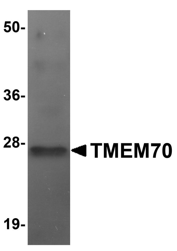 TMEM70 Antibody - Western blot analysis of TMEM70 in human liver tissue lysate with TMEM70 antibody at 1 ug/ml.