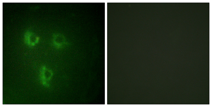 TMEPAI / PMEPA1 Antibody - Immunofluorescence analysis of HUVEC cells, using TMEPA Antibody. The picture on the right is blocked with the synthesized peptide.