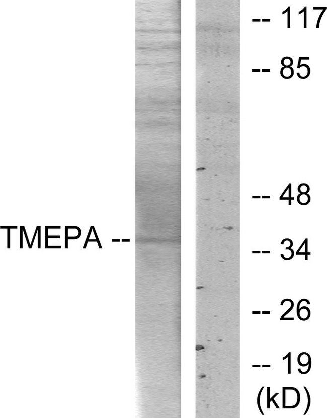 TMEPAI / PMEPA1 Antibody - Western blot analysis of lysates from HT-29 cells, using TMEPA Antibody. The lane on the right is blocked with the synthesized peptide.