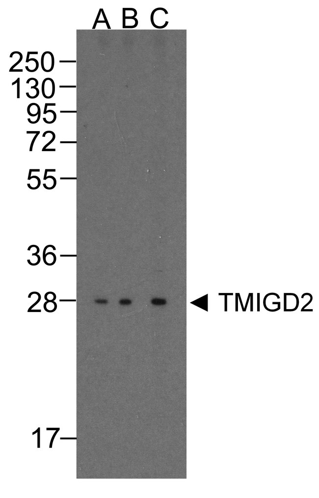TMIGD2 Antibody - Western blot analysis of TMIGD2 in overexpressing HEK293 cells TMIGD2 antibody at 0.25, 0.5, and 1 ug/ml