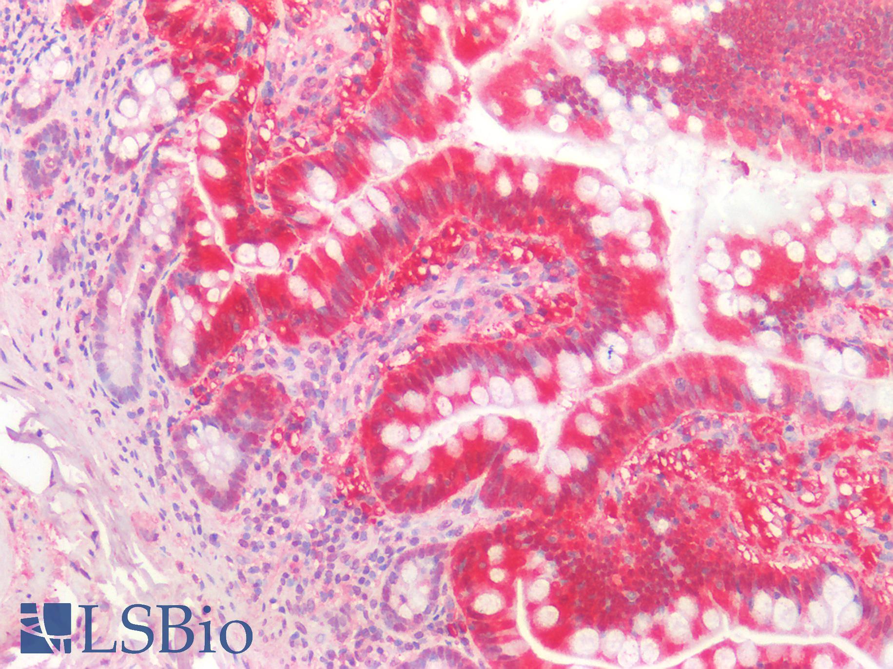 TMIGD2 Antibody - Human Small Intestine: Formalin-Fixed, Paraffin-Embedded (FFPE)