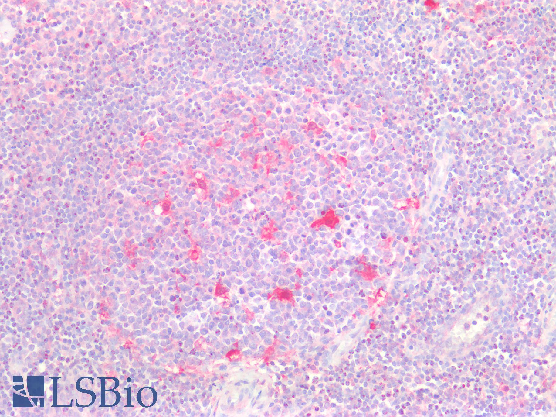 TMIGD2 Antibody - Human Tonsil: Formalin-Fixed, Paraffin-Embedded (FFPE)