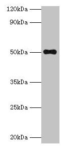 TMLHE / TMID Antibody - Western blot All lanes: Trimethyllysine dioxygenase, mitochondrial antibody at 2µg/ml + MCF-7 the whole cell lysate Secondary Goat polyclonal Rabbit IgG at 1/1000 dilution Predicted band size: 50, 47, 39, 45, 43, 42, 51 kDa Observed band size: 50 kDa