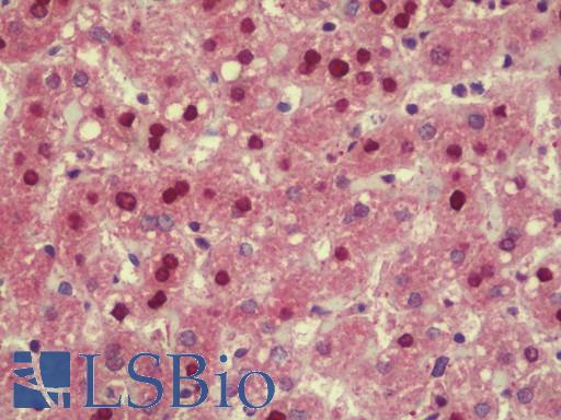 TMPO / TP / Thymopoietin Antibody - Anti-TMPO / TP / Thymopoietin antibody IHC staining of human liver. Immunohistochemistry of formalin-fixed, paraffin-embedded tissue after heat-induced antigen retrieval. Antibody concentration 2.5 ug/ml.