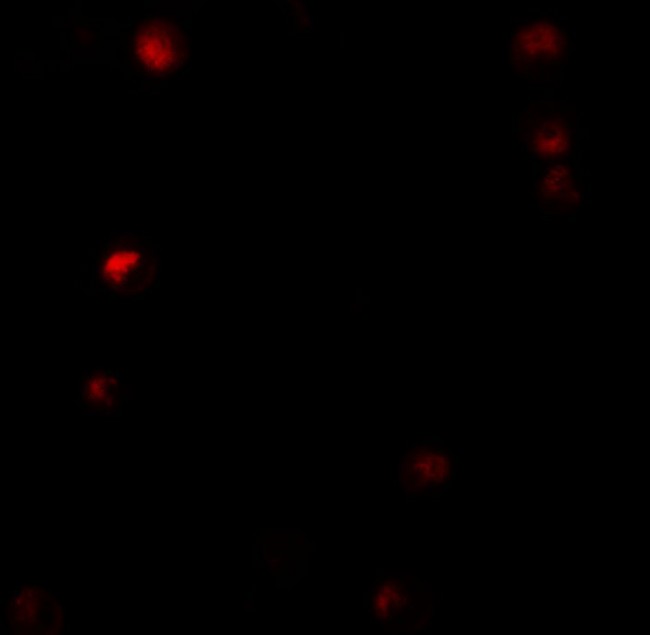 TMPO / TP / Thymopoietin Antibody - Immunofluorescence of Thymopoietin in HeLa cells with Thymopoietin antibody at 5 µg/mL.