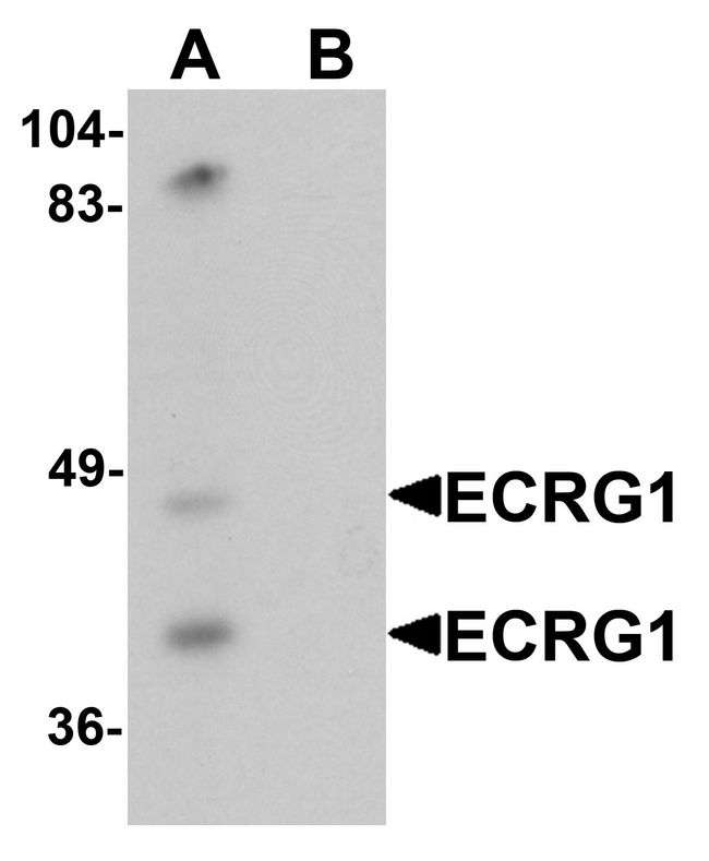 TMPRSS11A Antibody - Western blot analysis of ECRG1 in mouse liver tissue lysate with ECRG1 antibody at 1 ug/ml in (A) the absence and (B) the presence of blocking peptide.