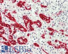 TMPRSS11E Antibody - Human Spleen: Formalin-Fixed, Paraffin-Embedded (FFPE)
