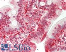 TMPRSS15 / Enterokinase Antibody - Human Small Intestine: Formalin-Fixed, Paraffin-Embedded (FFPE)
