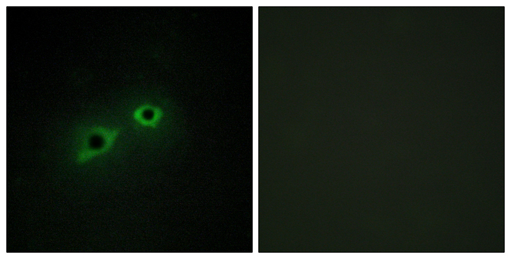 TMPRSS15 / Enterokinase Antibody - Immunofluorescence analysis of HepG2 cells, using ENTK Antibody. The picture on the right is blocked with the synthesized peptide.