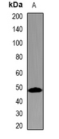 TMPRSS2 / Epitheliasin Antibody - Western blot analysis of TMPRSS2 expression in 22RV1 (A) whole cell lysates.