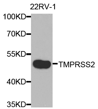 TMPRSS2 / Epitheliasin Antibody - Western blot analysis of extracts of 22RV-1 cells.
