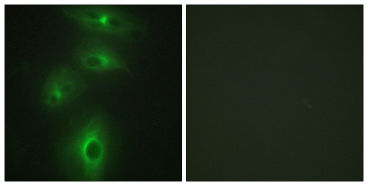TMPRSS3 Antibody - Immunofluorescence analysis of HeLa cells, using TMPRSS3 Antibody. The picture on the right is blocked with the synthesized peptide.