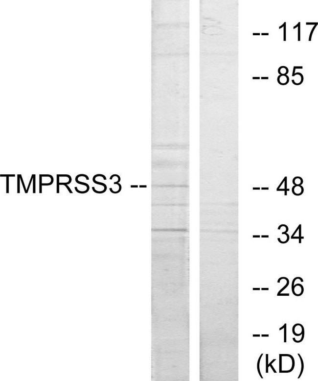 TMPRSS3 Antibody - Western blot analysis of lysates from HUVEC cells, using TMPRSS3 Antibody. The lane on the right is blocked with the synthesized peptide.