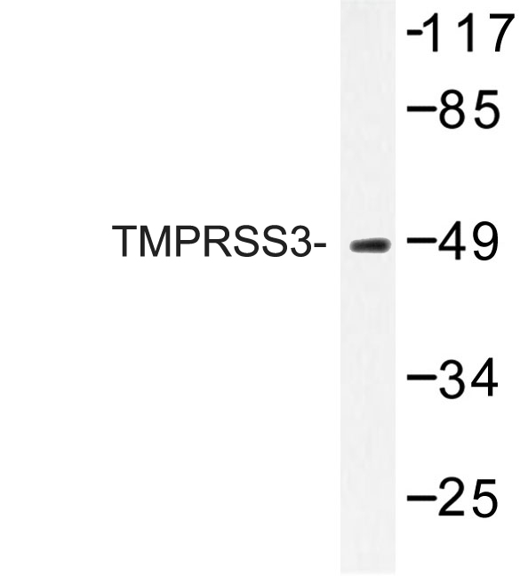TMPRSS3 Antibody - Western blot of TMPRSS3 (F440) pAb in extracts from HUVEC cells.