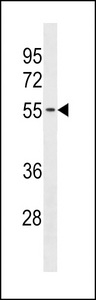 TMX3 Antibody - TMX3 Antibody western blot of A2058 cell line lysates (35 ug/lane). The TMX3 antibody detected the TMX3 protein (arrow).
