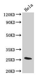 TNF Alpha Antibody - Western Blot Positive WB detected in: HepG2 whole cell lysate, Mouse heart tissue, Mouse liver tissue All lanes: TNF antibody at 4µg/ml Secondary Goat polyclonal to rabbit IgG at 1/50000 dilution Predicted band size: 26 kDa Observed band size: 26 kDa
