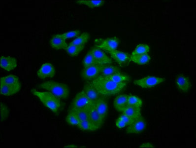 TNF Alpha Antibody