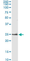 TNF Alpha Antibody - TNF monoclonal antibody. Western blot of TNF expression in rat liver.