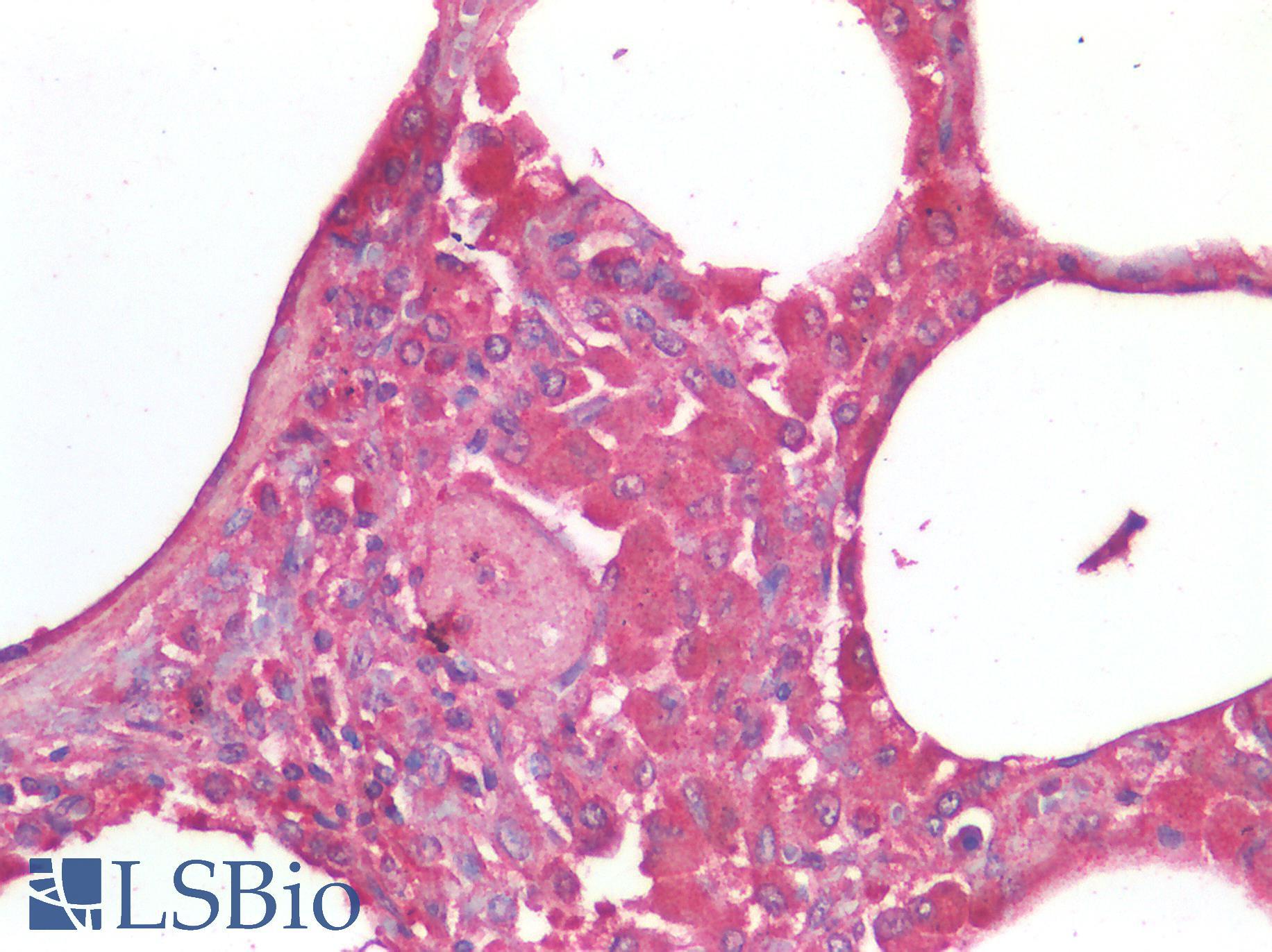 TNF Alpha Antibody - Human Lung: Formalin-Fixed, Paraffin-Embedded (FFPE)