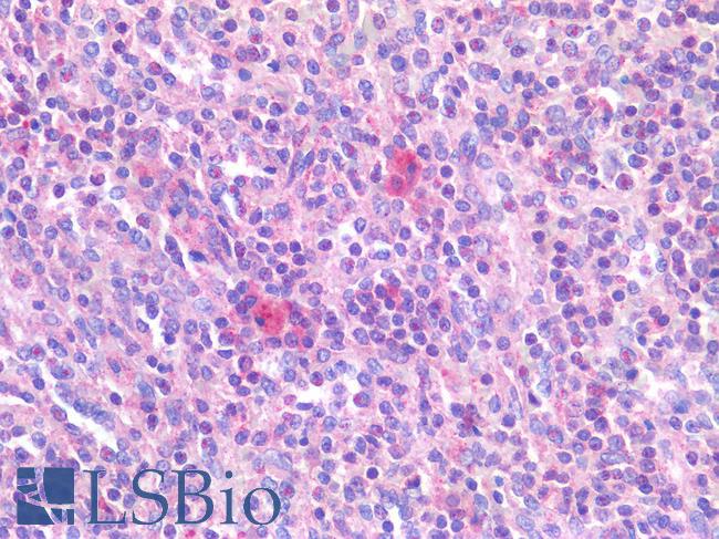 TNF Alpha Antibody - Human Spleen: Formalin-Fixed, Paraffin-Embedded (FFPE)