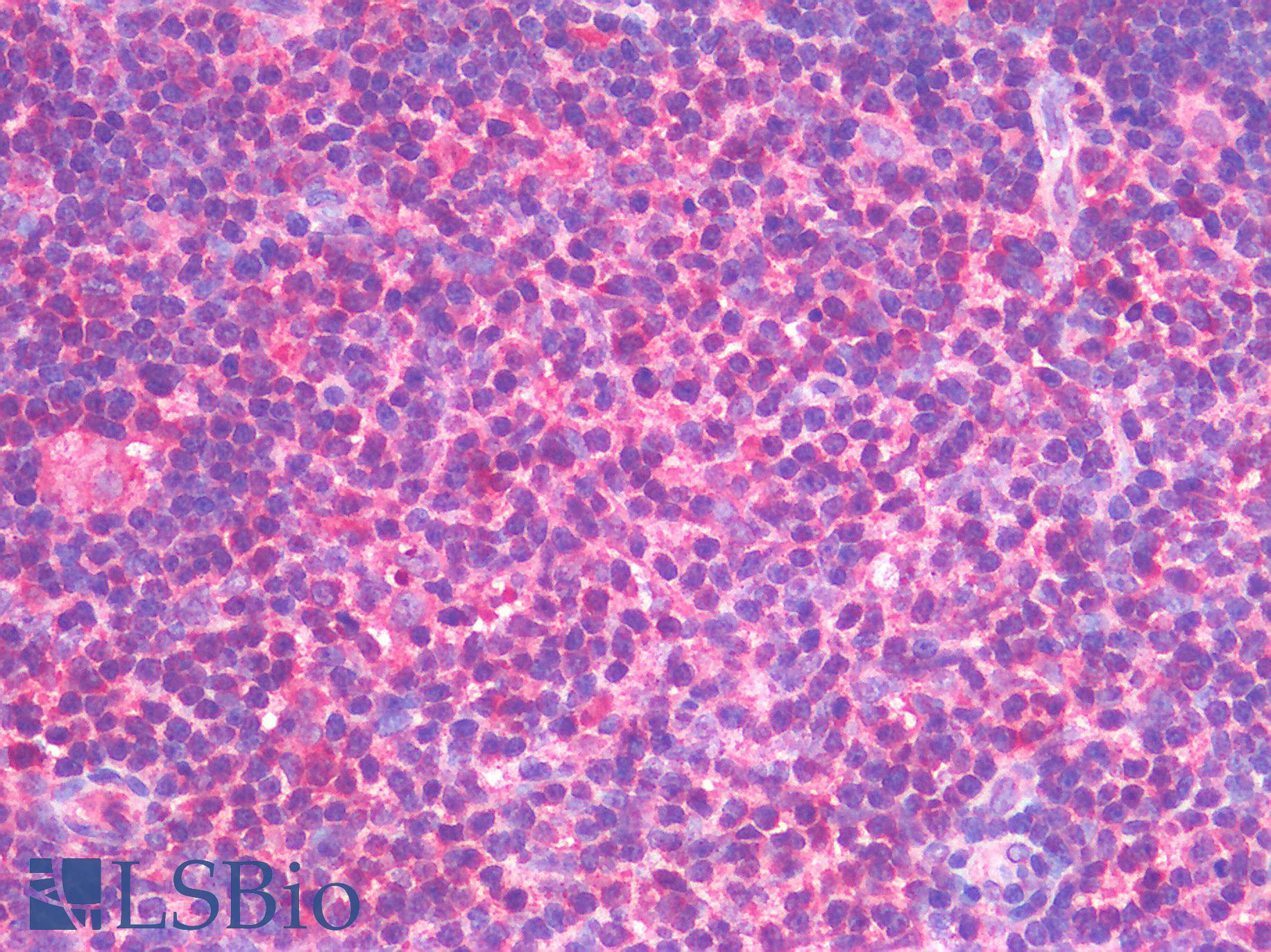 TNF Alpha Antibody - Human Thymus: Formalin-Fixed, Paraffin-Embedded (FFPE)