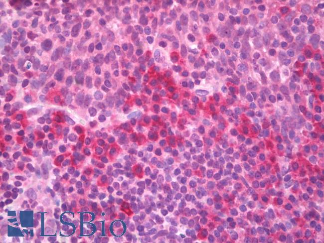 TNF Alpha Antibody - Anti-TNF Alpha / TNF antibody IHC of human tonsil. Immunohistochemistry of formalin-fixed, paraffin-embedded tissue after heat-induced antigen retrieval. Antibody dilution 5 ug/ml.