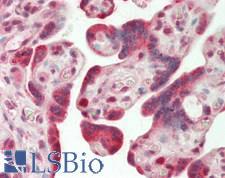 TNFAIP1 Antibody - Human Placenta: Formalin-Fixed, Paraffin-Embedded (FFPE)