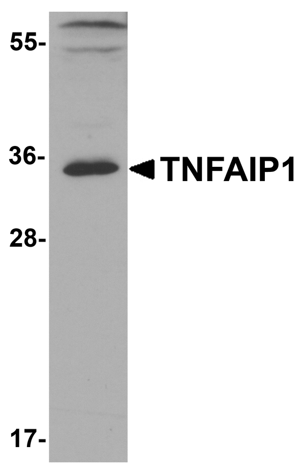 TNFAIP1 Antibody - Western blot analysis of TNFAIP1 in mouse brain tissue lysate with TNFAIP1 antibody at 1 ug/ml.