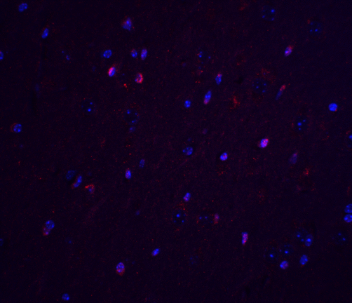 TNFAIP1 Antibody - Immunofluorescence of TNFAIP1 in mouse brain tissue with TNFAIP1 antibody at 20 ug/ml.  Red: TNFAIP1 Antibody  Blue: DAPI staining