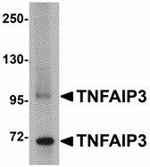 TNFAIP3 / A20 Antibody - Western blot of TNFAIP3 in SK-N-SH cell lysate with TNFAIP3 antibody at 1 ug/ml.