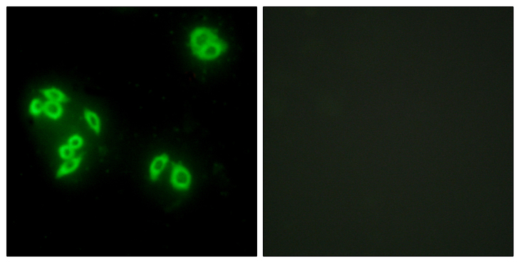TNFAIP8 / SCC-S2 Antibody - Immunofluorescence analysis of A549 cells, using TFIP8 Antibody. The picture on the right is blocked with the synthesized peptide.