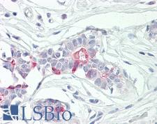 TNFAIP8 / SCC-S2 Antibody - Anti-SCC-S2 / TNFAIP8 antibody IHC of human breast. Immunohistochemistry of formalin-fixed, paraffin-embedded tissue after heat-induced antigen retrieval. Antibody dilution 5 ug/ml.