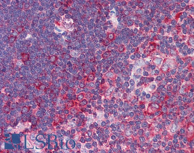 TNFRSF10A / DR4 Antibody - Anti-TNFRSF10A / DR4 antibody IHC of human thymus. Immunohistochemistry of formalin-fixed, paraffin-embedded tissue after heat-induced antigen retrieval. Antibody concentration 5 ug/ml.