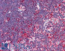 TNFRSF10A / DR4 Antibody - Anti-TNFRSF10A / DR4 antibody IHC of human thymus. Immunohistochemistry of formalin-fixed, paraffin-embedded tissue after heat-induced antigen retrieval. Antibody concentration 5 ug/ml.