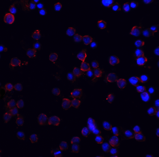 TNFRSF10A / DR4 Antibody - Immunocytochemistry of DR4 in Hela cells with DR4 antibody at 2 ug/mL.