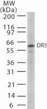 TNFRSF10B / Killer / DR5 Antibody - Western blot of 20 ug of whole cell lysates from HL60 cells with anti-DR5 at 5 ug/ml?dilution.