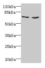TNFRSF11A / RANK Antibody - Western blot All lanes: Tumor necrosis factor receptor superfamily member 11A antibody at 2µg/ml Lane 1: EC109 whole cell lysate Lane 2: 293T whole cell lysate Secondary Goat polyclonal to rabbit IgG at 1/15000 dilution Predicted band size: 67, 33, 37, 29, 57, 65 kDa Observed band size: 67 kDa