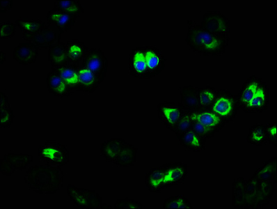 TNFRSF11A / RANK Antibody - Immunofluorescence staining of PC-3 cells with TNFRSF11A Antibody at 1:133, counter-stained with DAPI. The cells were fixed in 4% formaldehyde, permeabilized using 0.2% Triton X-100 and blocked in 10% normal Goat Serum. The cells were then incubated with the antibody overnight at 4°C. The secondary antibody was Alexa Fluor 488-congugated AffiniPure Goat Anti-Rabbit IgG(H+L).