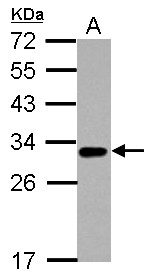 TNFRSF14 / CD270 / HVEM Antibody - Sample (30 ug of whole cell lysate) A: A431 12% SDS PAGE TNFRSF14 / CD270 antibody diluted at 1:1000