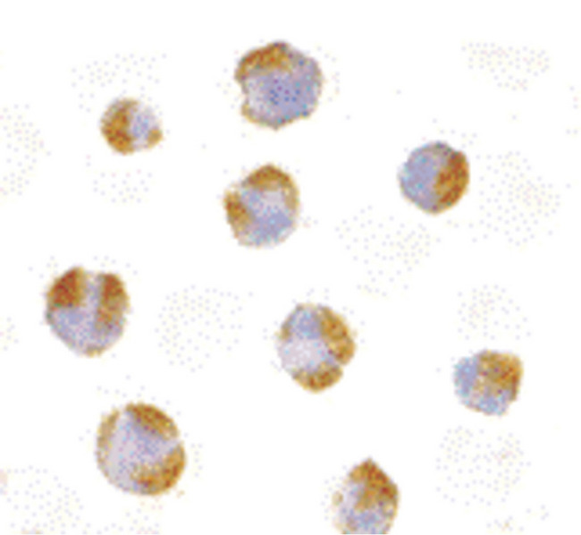 TNFRSF14 / CD270 / HVEM Antibody - Immunocytochemistry of TNFRSF14 in Raji with TNFRSF14 antibody at 10 ug/ml.