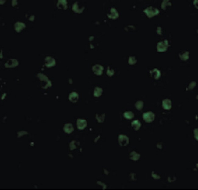 TNFRSF14 / CD270 / HVEM Antibody - Immunofluorescence of TNFRSF14 in Raji cells with TNFRSF14 antibody at 20 ug/ml.